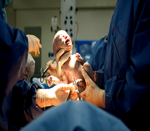 Best Hospital For Laparoscopic Surgery in Silchar