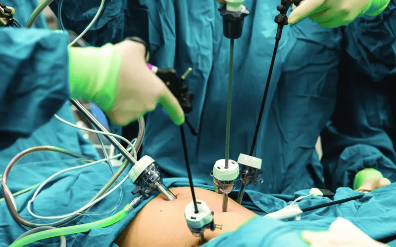 Best Hospital For Laparoscopic Surgery in Silchar