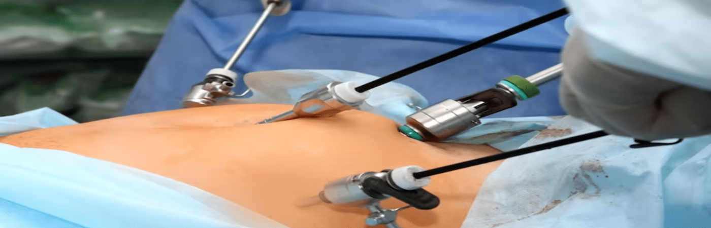 Best Hospital For Laparoscopic Surgery in Silchar